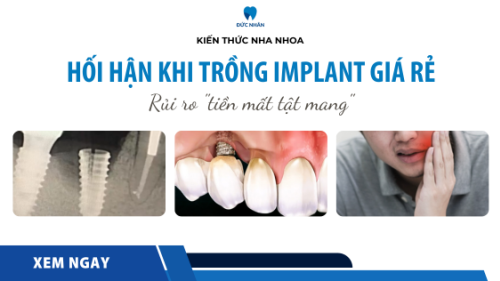 Hối hận khi trồng Implant giá rẻ - Những rủi ro 